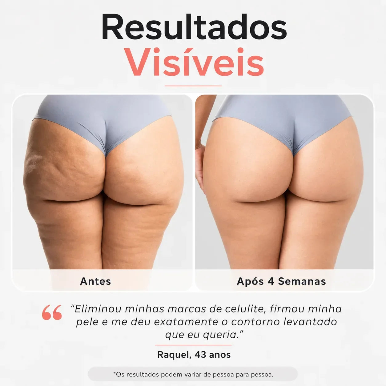 Aparelho Redutor De Celulite ReduSculpt